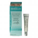 wallen en donkere kringen