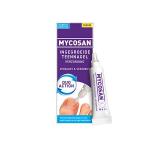 Ingegroeide teennagel...